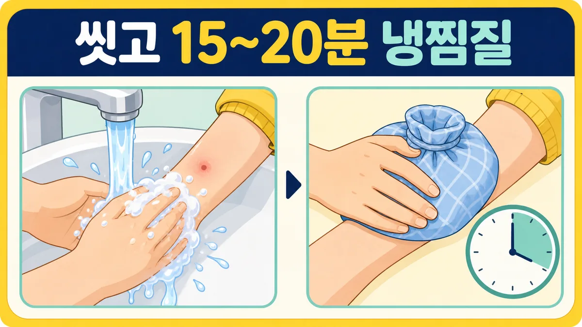 벌 쏘인 부위를 비누와 흐르는 물로 씻고 천으로 감싼 냉찜질을 15~20분 하는 과정