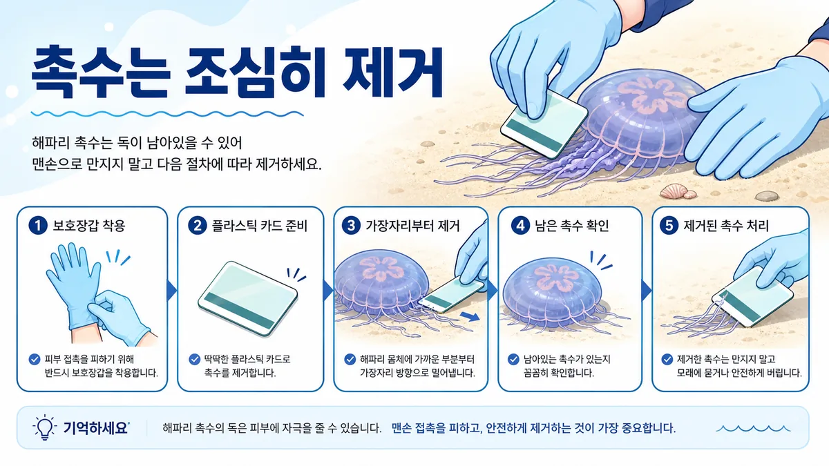 보호장갑과 플라스틱 카드를 이용해 남은 해파리 촉수를 조심스럽게 제거하는 절차 이미지